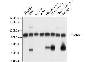 Western blot analysis of extracts of various cell lines, using POMGNT2 antibody (ABIN7267482) at 1:3000 dilution. (C3orf39 Antikörper  (AA 160-340))