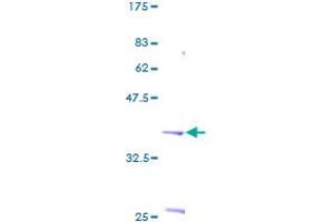 SDS-PAGE (SDS) image for S100 Calcium Binding Protein P (S100P) (AA 1-95) protein (GST tag) (ABIN1319082) (S100P Protein (AA 1-95) (GST tag))