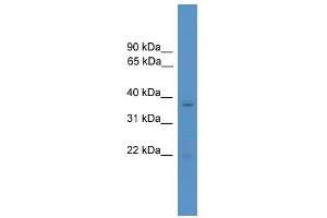 WB Suggested Anti-RHOXF1 Antibody Titration:  0. (RHOXF1 Antikörper  (N-Term))