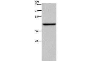 Western Blot analysis of Mouse liver tissue using ENTPD5 Polyclonal Antibody at dilution of 1:500 (ENTPD5 Antikörper)