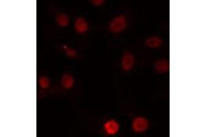 ABIN6274222 staining Hela cells by IF/ICC. (ERCC5 Antikörper  (N-Term))
