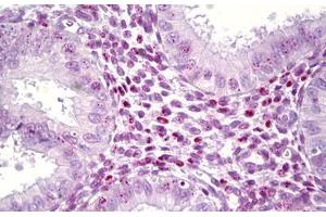 Anti-HMGB1 antibody IHC staining of human, uterus. (HMGB1 Antikörper  (AA 131-180))