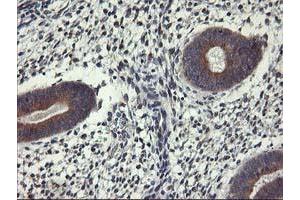 Immunohistochemical staining of paraffin-embedded Human endometrium tissue using anti-ALG2 mouse monoclonal antibody. (ALG2 Antikörper)