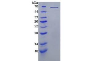 SDS-PAGE analysis of Mouse Perforin 1 Protein.