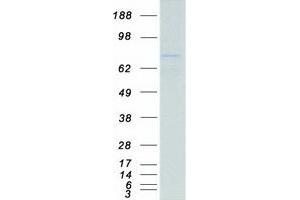Western Blotting (WB) image for Forkhead Box O3 (FOXO3) (Transcript Variant 1) protein (Myc-DYKDDDDK Tag) (ABIN2712289)