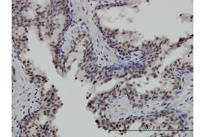 Immunoperoxidase of monoclonal antibody to STK32C on formalin-fixed paraffin-embedded human prostate. (STK32C Antikörper  (AA 1-369))
