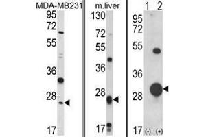 (LEFT) Western blot analysis of GSTM1 Antibody (C-term) in MDA-MB231 cell line lysates (35 µg/lane). (GSTM1 Antikörper  (C-Term))