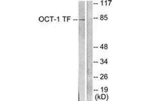 Western blot analysis of extracts from HeLa cells, using OCT1 Antibody. (POU2F1 Antikörper  (AA 41-90))