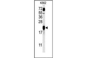 Western blot analysis of GAGE7 Antibody (C-term) in K562 cell line lysates (35ug/lane). (G Antigen 7 Antikörper  (C-Term))