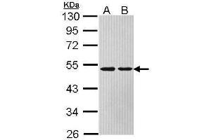 WB Image Sample (30 ug of whole cell lysate) A: Hela B: Hep G2 , 10% SDS PAGE antibody diluted at 1:1000 (ASL Antikörper)