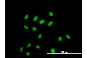 Immunofluorescence of monoclonal antibody to CDYL on HeLa cell. (CDYL Antikörper  (AA 153-260))
