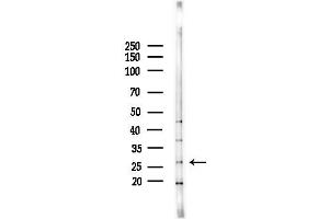 anti-Kallikrein 9 (KLK9) (C-Term) antibody