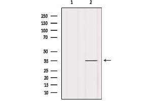 Western blot analysis of extracts from Mouse spleen, using OR1A2 Antibody.