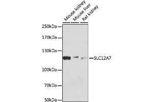Western blot analysis of extracts of various cell lines, using SLC12 antibody (ABIN6131138, ABIN6147845, ABIN6147846 and ABIN6215907) at 1:1000 dilution. (SLC12A7 Antikörper  (AA 1-70))