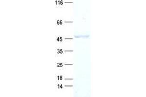 Validation with Western Blot (ACOT1 Protein (His tag))