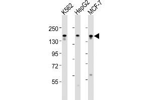 All lanes : Anti-RGEF1 Antibody (Center) at 1:1000-1:2000 dilution Lane 1: K562 whole cell lysates Lane 2: HepG2 whole cell lysates Lane 3: MCF-7 whole cell lysates Lysates/proteins at 20 μg per lane. (GRF2 Antikörper  (AA 536-569))