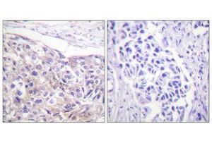 Immunohistochemistry (IHC) image for anti-Ribosomal Protein S6 Kinase, 90kDa, Polypeptide 3 (RPS6KA3) (pThr573) antibody (ABIN1847291) (RPS6KA3 Antikörper  (pThr573))