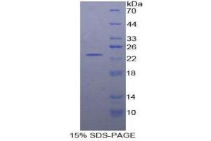 SDS-PAGE (SDS) image for Regulator of G-Protein Signaling 4 (RGS4) (AA 38-205) protein (His tag) (ABIN2126652)