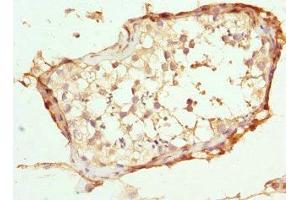 Immunohistochemistry of paraffin-embedded human testis tissue using ABIN7144903 at dilution of 1:100 (ABCC11 Antikörper  (AA 1-170))