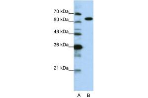 WB Suggested Anti-KARS Antibody Titration:  0. (KARS Antikörper  (C-Term))