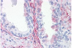 Human Prostate: Formalin-Fixed, Paraffin-Embedded (FFPE) (Aquaporin 8 Antikörper  (AA 1-255))
