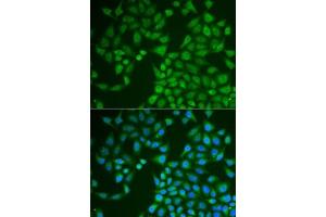 Immunofluorescence analysis of U2OS cells using PNLIP antibody (ABIN6128521, ABIN6145838, ABIN6145840 and ABIN6222025). (PNLIP Antikörper  (AA 166-465))
