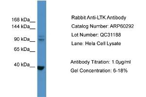 WB Suggested Anti-LTK  Antibody Titration: 0.