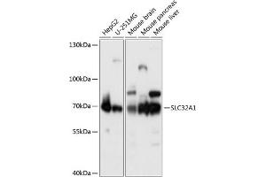 Western blot analysis of extracts of various cell lines, using SLC32 antibody (2610) at 1:1000 dilution. (SLC32A1 Antikörper  (AA 1-120))