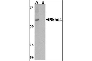 Western blot analysis of Rkhd4 in SK-N-SH cell lysate with this product at 1 μg/ml in (A) the absence and (B) the presence of blocking peptide. (MEX3A Antikörper  (C-Term))