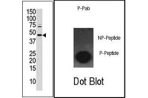 Image no. 1 for anti-Jun Proto-Oncogene (JUN) (pSer63) antibody (ABIN358111) (C-JUN Antikörper  (pSer63))