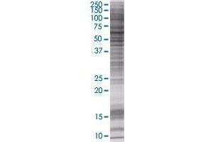PDE9A transfected lysate. (PDE9A 293T Cell Transient Overexpression Lysate(Denatured))