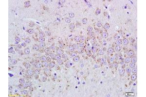 Formalin-fixed and paraffin embedded rat brain tissue labeled with Anti-cGMP Polyclonal Antibody, Unconjugated (ABIN750733) at 1:400, followed by conjugation to the secondary antibody and DAB staining (Cyclic GMP Antikörper)