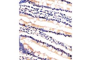 Immunohistochemical analysis of paraffin-embedded H. (UBE2K Antikörper  (AA 109-139))