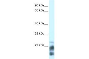 WB Suggested Anti-MDP-1 Antibody Titration: 0. (MDP1 Antikörper  (N-Term))