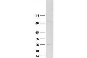 Validation with Western Blot (APOBEC3C Protein (Myc-DYKDDDDK Tag))