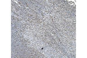 IHC analysis of PDIA5 using anti-PDIA5 antibody (ABIN7601801). (PDIA5 Antikörper  (AA 46-481))