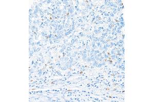 Immunohistochemistry (IHC) image for anti-Integrin, alpha E (Antigen CD103, Human Mucosal Lymphocyte Antigen 1, alpha Polypeptide) (ITGAE) (AA 400-450) antibody (ABIN7455115)
