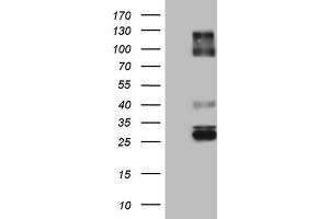 Western Blotting (WB) image for anti-Immunoglobulin Superfamily, Member 11 (IGSF11) (AA 23-241) antibody (ABIN2674600) (IGSF11 Antikörper  (AA 23-241))