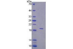 SDS-PAGE analysis of Human Corticosteroid Binding Globulin (CBG) Protein. (SERPINA6 Protein)