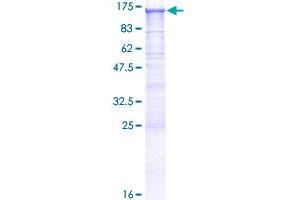 Desmocollin 2 Protein (DSC2) (AA 1-847) (GST tag)