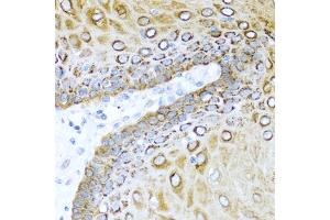 Immunohistochemistry of paraffin-embedded human esophagus using S100A7 antibody. (S100A7 Antikörper)