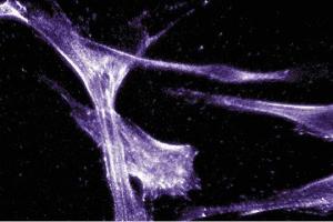 Immunofluorescent staining of Hs68 cells with anti-Actin Ab-5. (Actin Antikörper)