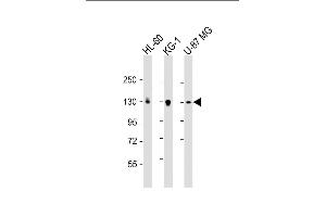 All lanes : Anti-DEPD5 Antibody (C-term) at 1:2000 dilution Lane 1: HL-60 whole cell lysate Lane 2: KG-1 whole cell lysate Lane 3: U-87 MG whole cell lysate Lysates/proteins at 20 μg per lane. (DEPDC5 Antikörper  (AA 1404-1432))