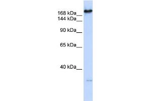 WB Suggested Anti-CAD Antibody Titration:  0.