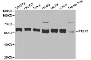 Western blot analysis of extracts of various cell lines, using PTBP1 antibody. (PTBP1 Antikörper  (AA 1-100))