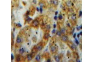 Used in DAB staining on fromalin fixed paraffin-embedded Kidney tissue (Tissue factor Antikörper  (AA 30-251))