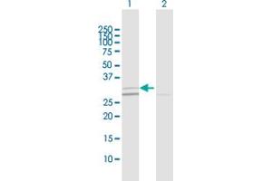 Western Blot analysis of SIRT5 expression in transfected 293T cell line by SIRT5 MaxPab polyclonal antibody. (SIRT5 Antikörper  (AA 1-310))