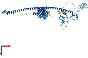 MID1 Protein (AA 1-667) (His tag)