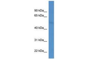 Image no. 1 for anti-Coronin, Actin Binding Protein, 2B (CORO2B) (AA 275-324) antibody (ABIN6746343) (CORO2B Antikörper  (AA 275-324))