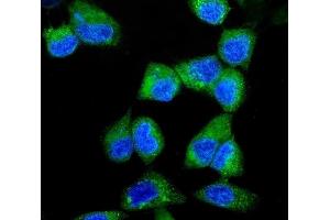 IF analysis of ITCH/AIP4 using anti-ITCH/AIP4 antibody (ABIN7600264). (ITCH Antikörper  (AA 17-358))